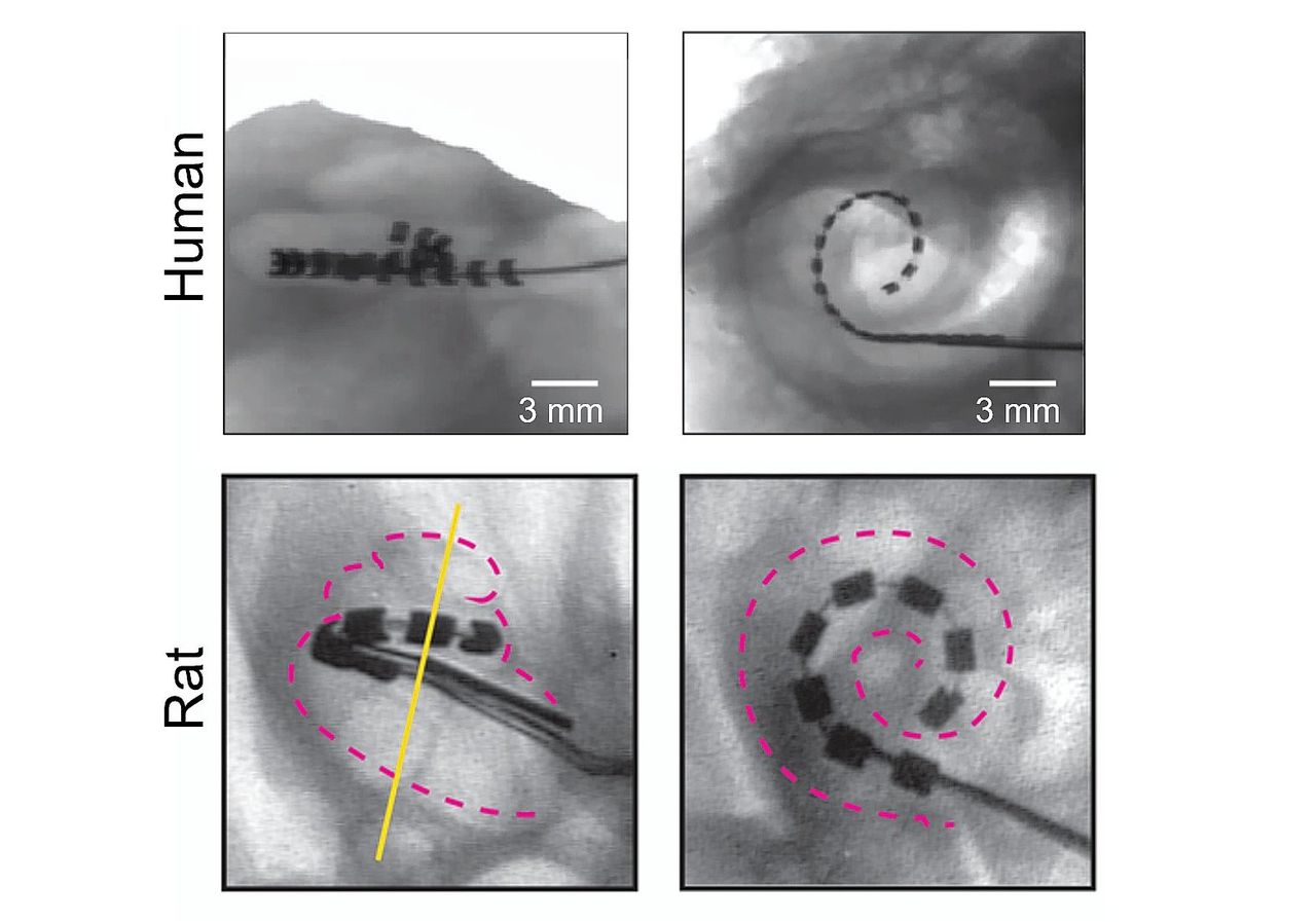 Cochleaire implantaten bij mens (boven) en rat, opgerold in het slakkenhuis van het oor. Het menselijk implantaat telt 22 kanalen, die elk een geluidsfrequentieband registreren. Bij de rat zijn er 8.