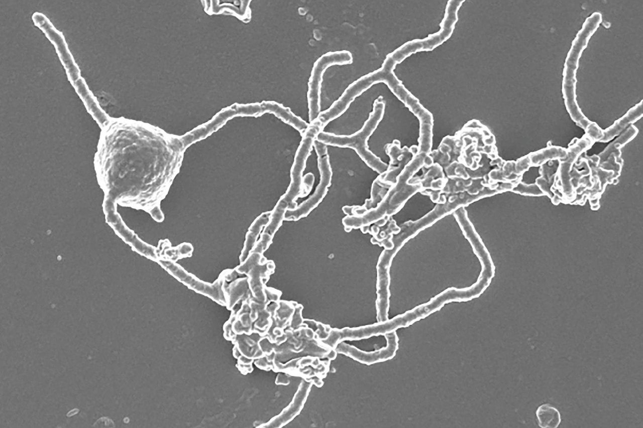 Beeld gemaakt met een elektronenmicroscoop door de Japanse onderzoekers uit 2020: Prometheoarchaeum syntrophicum.