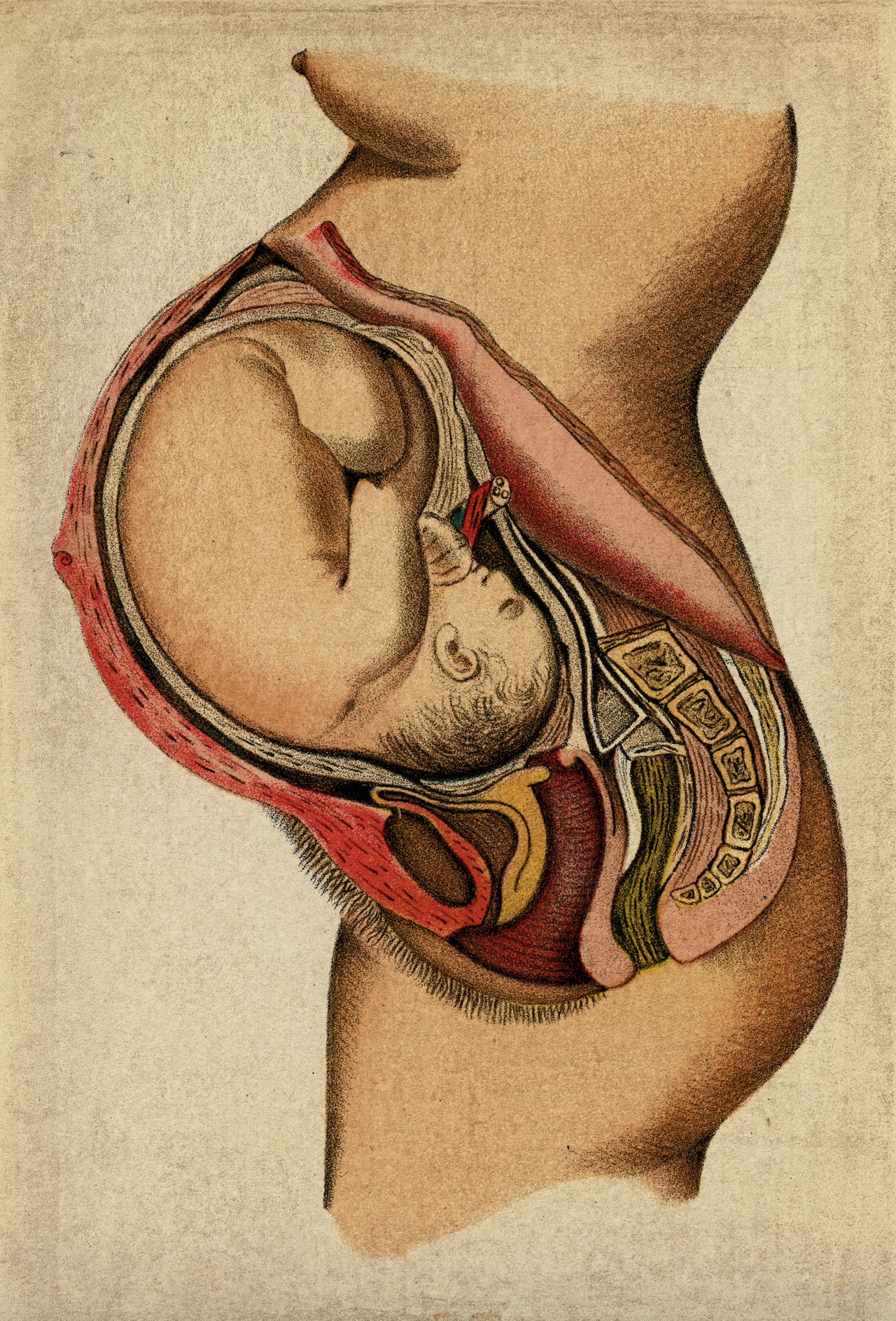 Afbeelding uit 1892. Pas in 1984 werd abortus legaal.