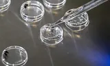 In een Duitse vruchtbaarheidskliniek worden petrischaaltjes voorbereid om bevruchte eicellen in te verzamelen. 