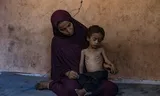 De tweejarige Yazan Abu Foul zit op schoot bij zijn moeder, in de buurt van Gaza-Stad. Hij is ernstig ondervoed door de aanhoudende Israëlische blokkade van hulpgoederen. 